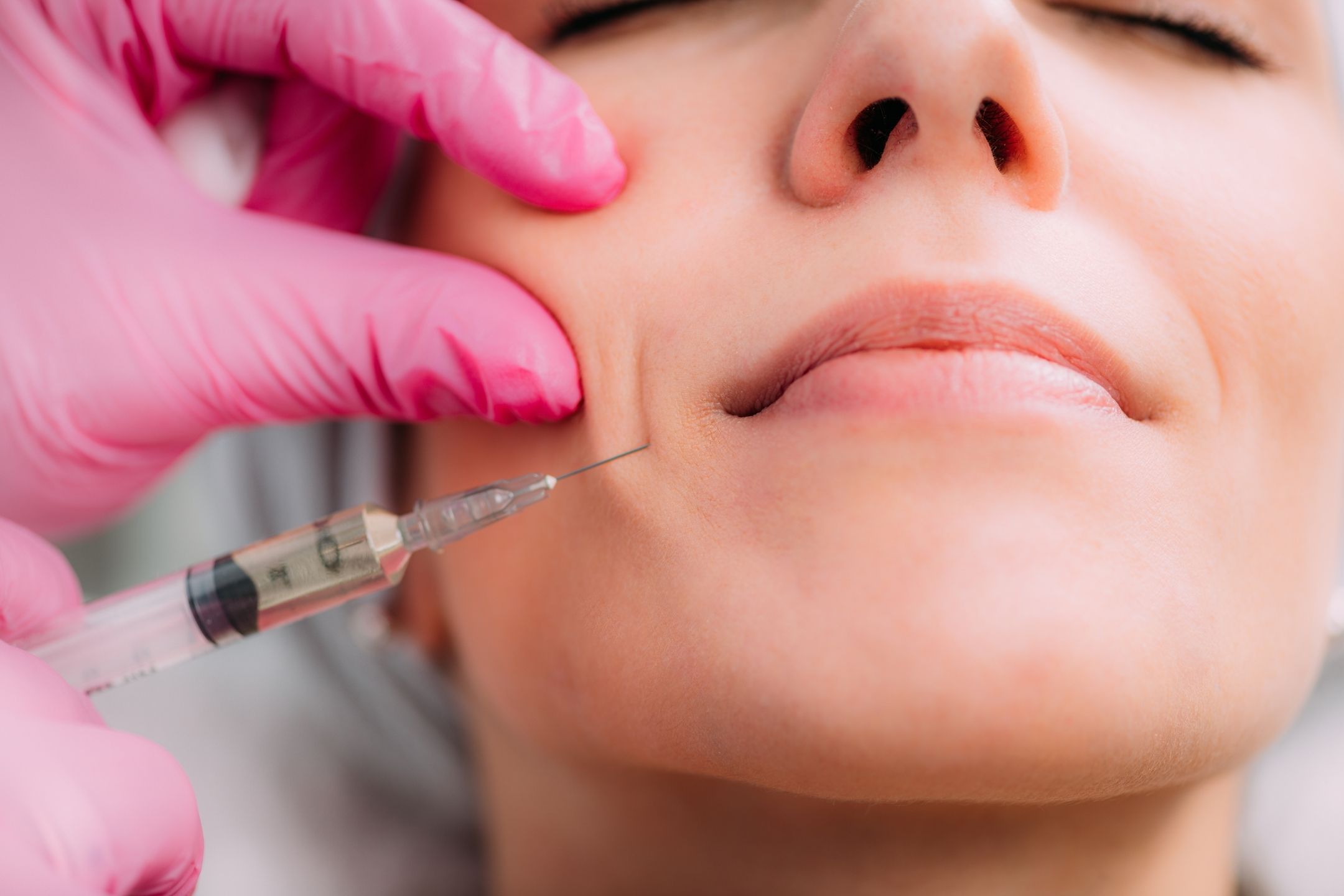 The Different Types of Injectable Dermal Fillers